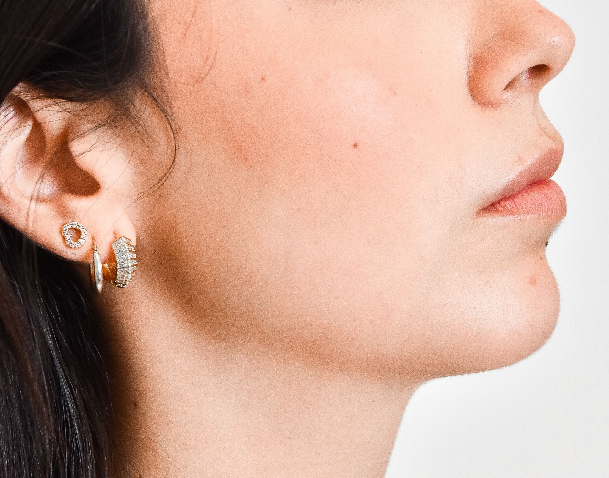 mentoplastica - Pietro Serra Chirurgo Plastico