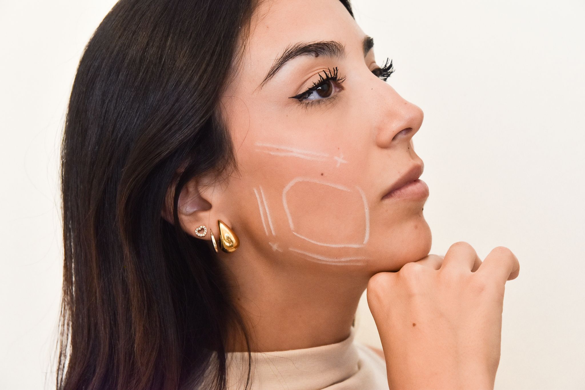 Acido Polilattico - Pietro Serra Chirurgo Plastico